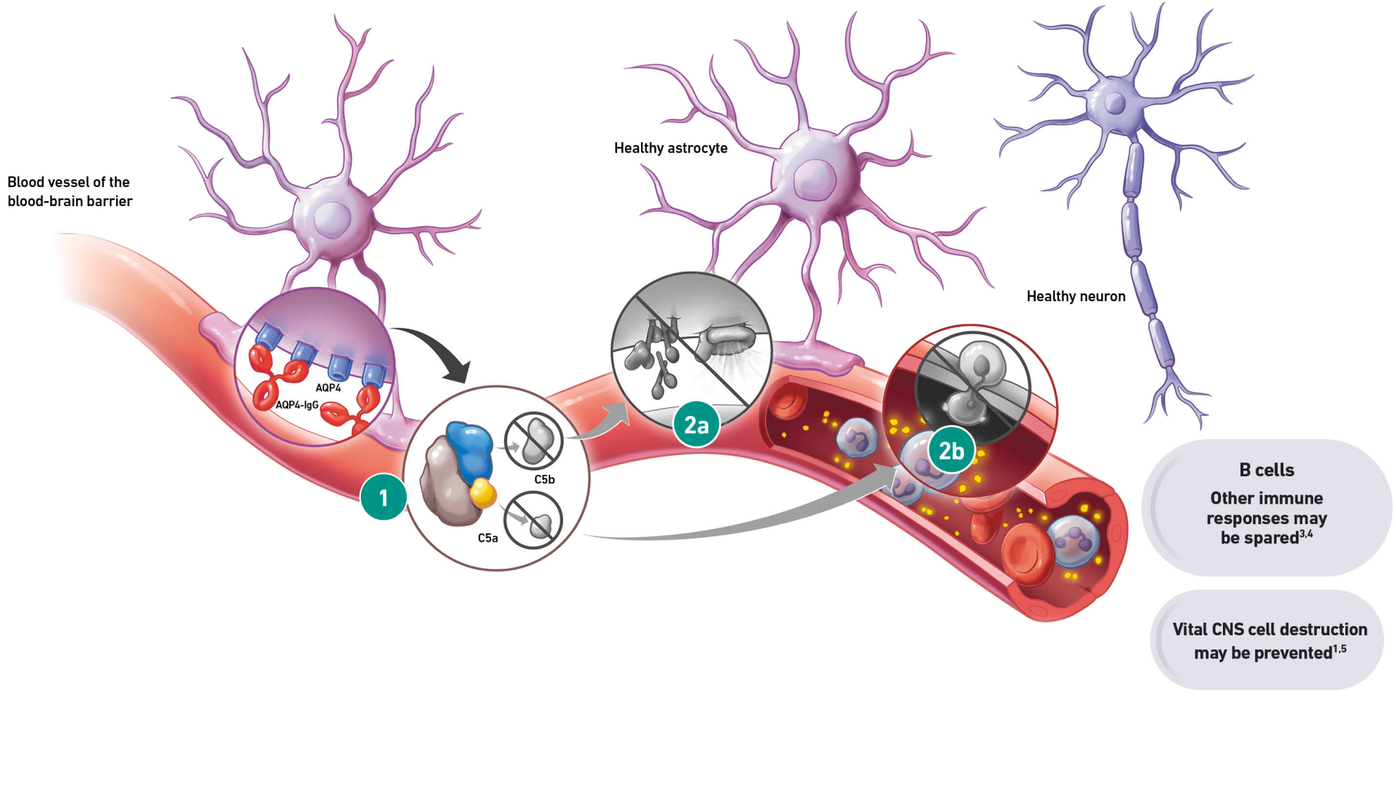 ULTOMIRIS inhibits C5 cleavage to help prevent damage to the CNS
